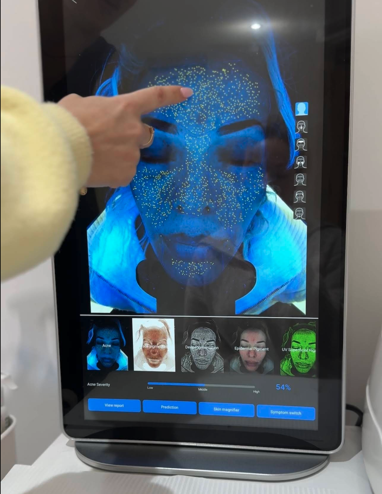 Lyuba N.'s skin analysis